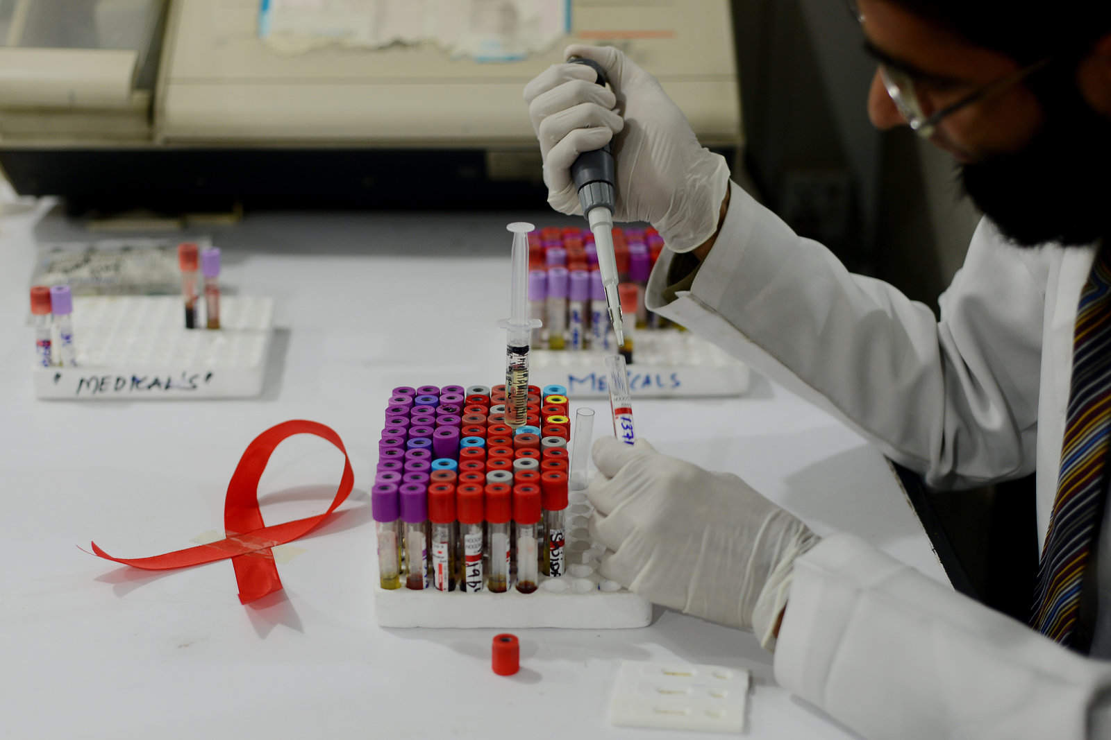 HIV researchers edge closer to a cure